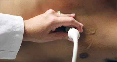 77A788F6-6B07-4D15-8351-555FDDECCE13